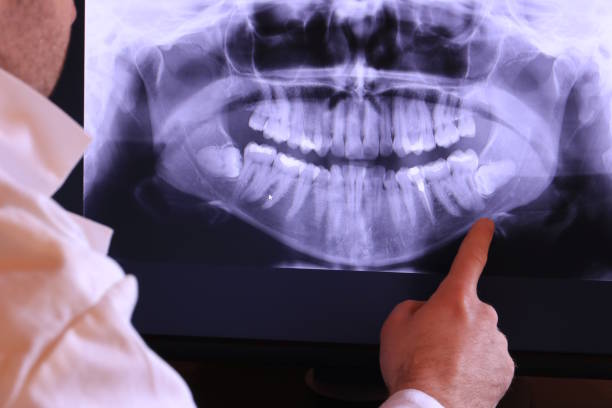 Best Pediatric Emergency Dentist in Montclair, CA