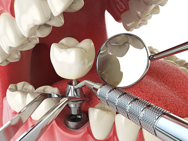 Best Emergency Cosmetic Dentistry in Montclair, CA
